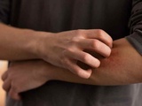 Démangeaisons sur tout le corps : et si c’était votre foie
